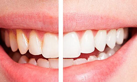 牙齒開始“衰老”的三大癥狀，你可要當心了